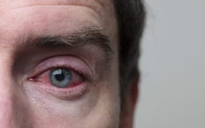 Podpora liečby infekcie oka vďaka ozonizovaným olejom v lipozómoch