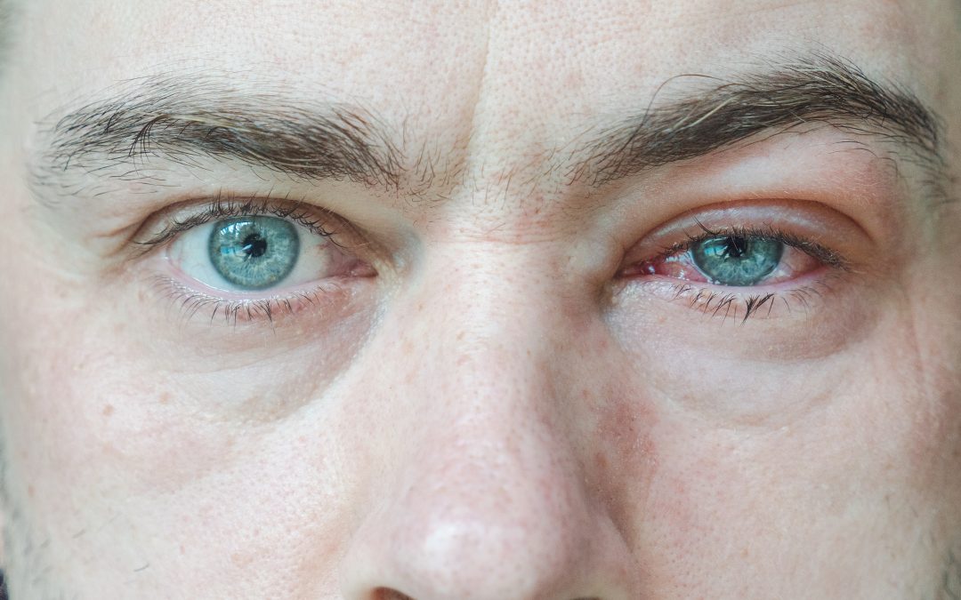 Ozón a ozonizované oleje v lipozómoch pre podporu liečby infekcií oka